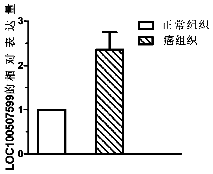 Application of non-coding RNA relevant to occurrence and development of laryngeal squamous cell carcinoma