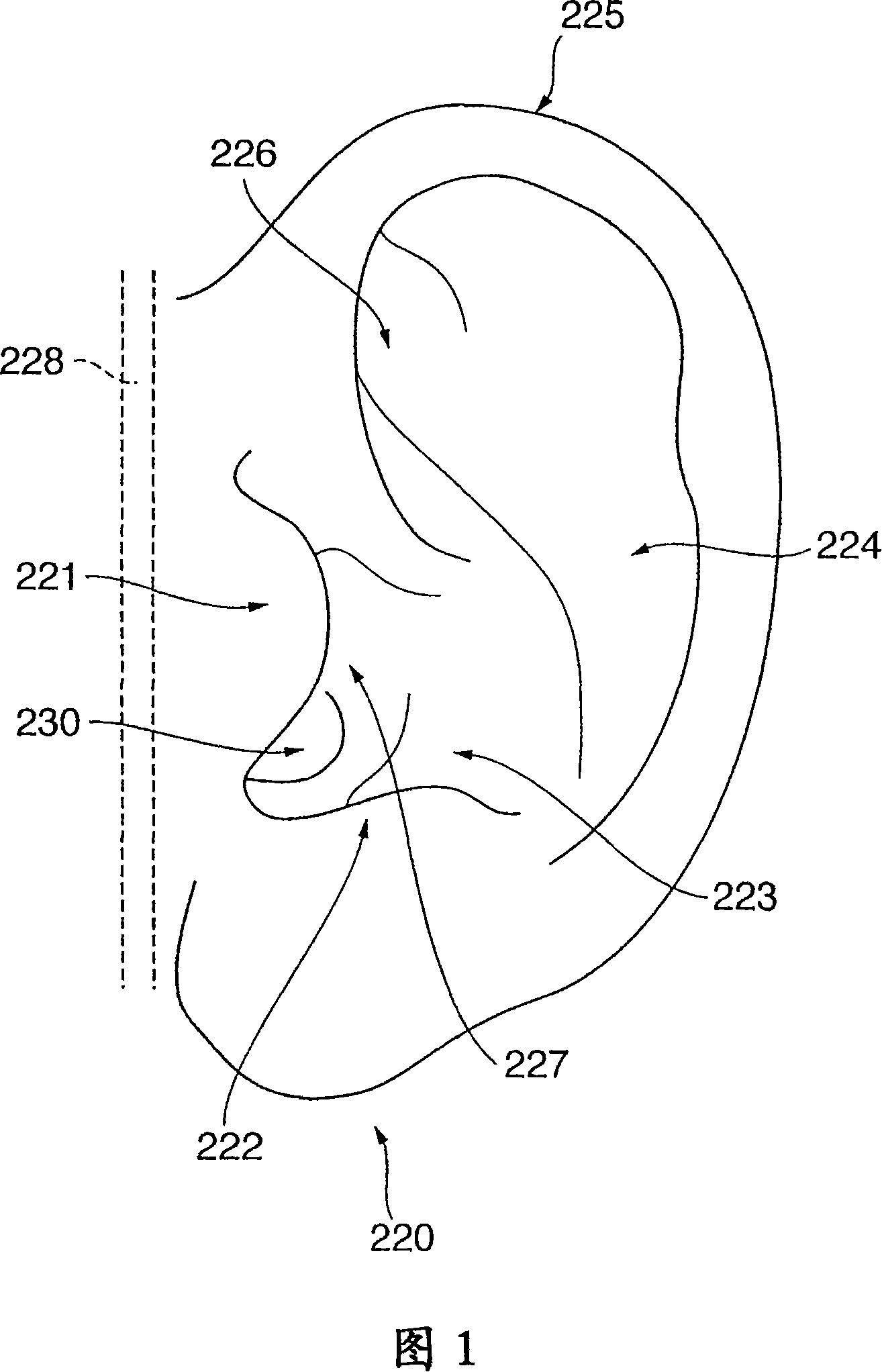 Blood pressure measuring apparatus