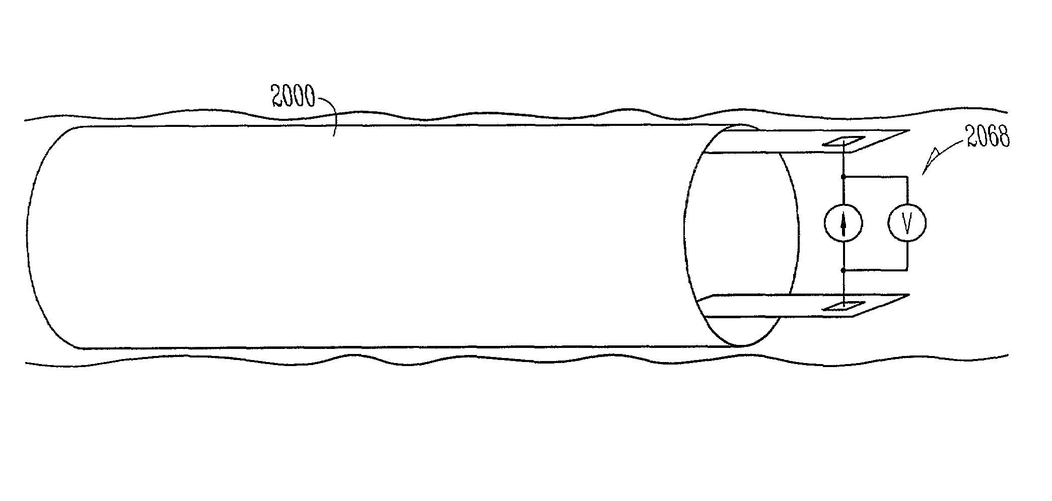 Chronically-implanted device for sensing and therapy