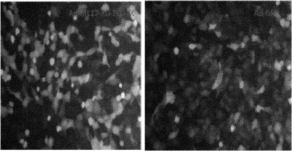 Recombinant adenovirus and application thereof