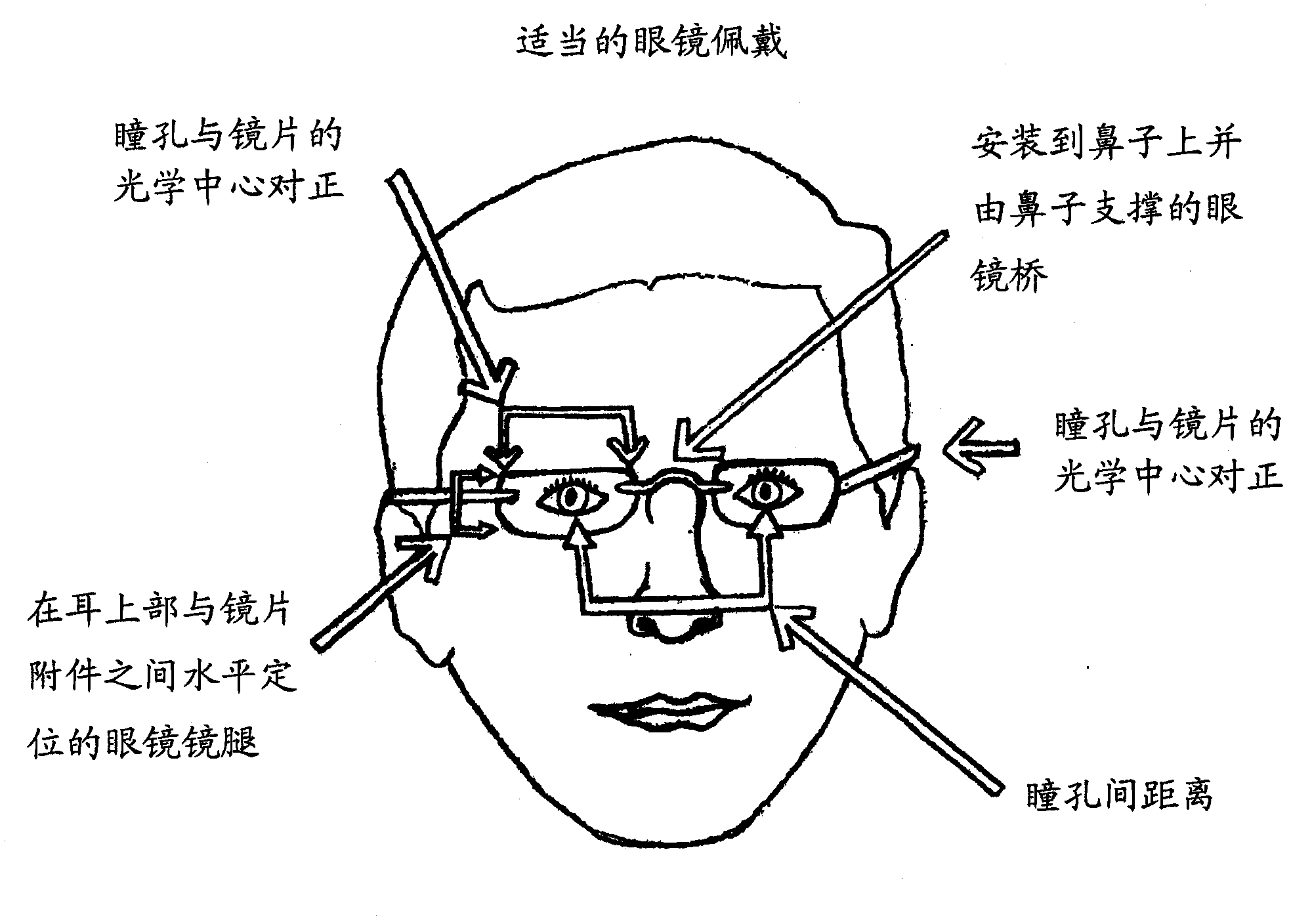 Spectacle assembly for faces without a prominent upper nasal support