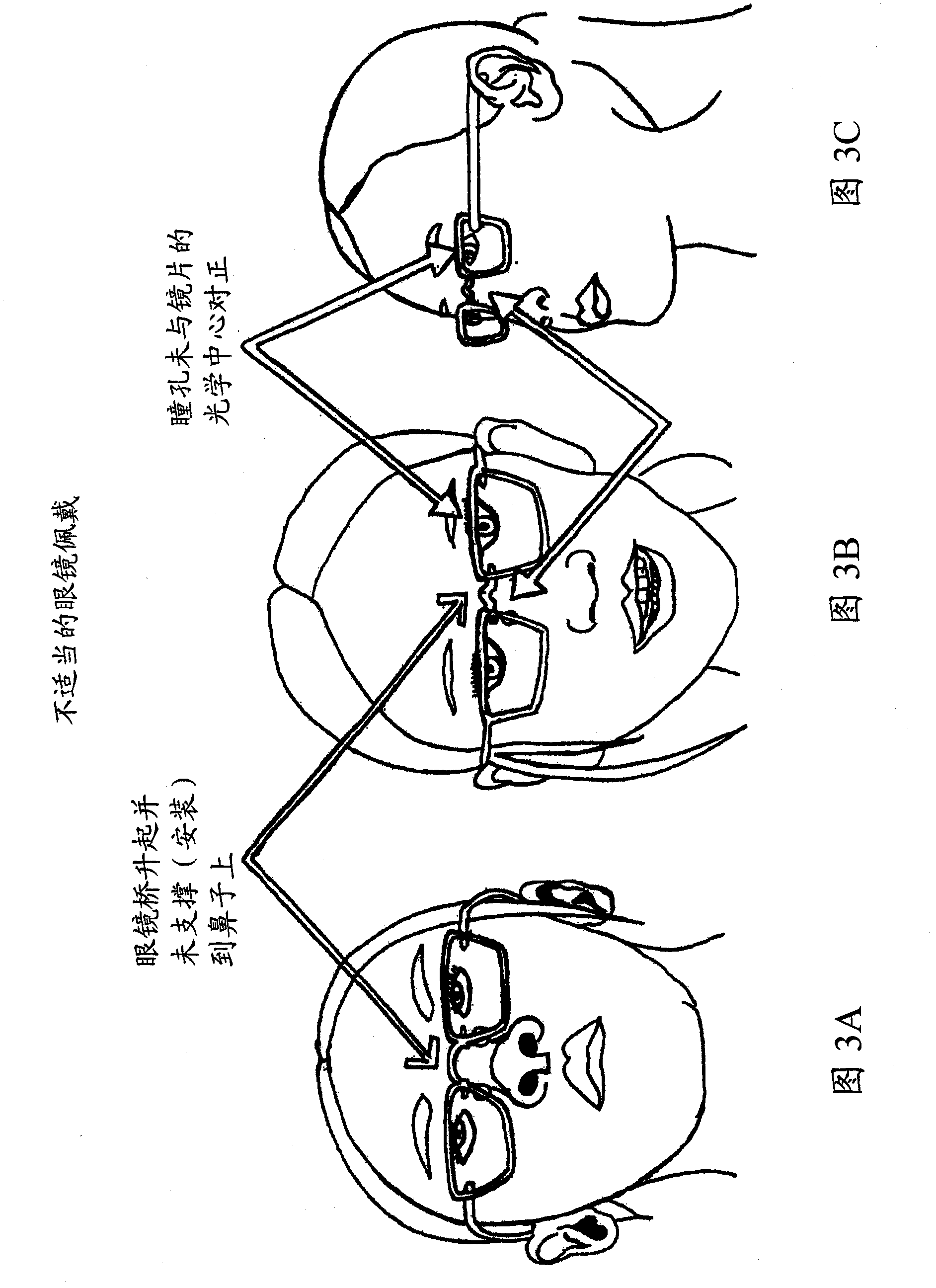 Spectacle assembly for faces without a prominent upper nasal support