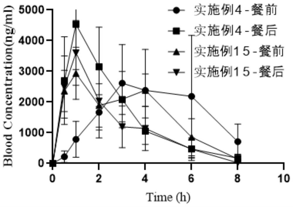 Oral abiraterone pharmaceutical composition and preparation method and use thereof