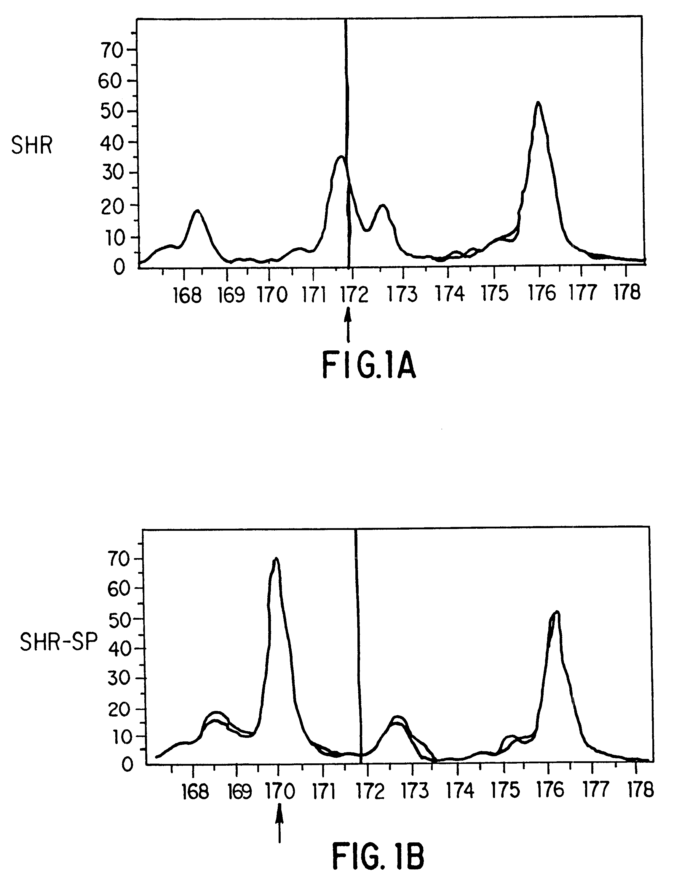 Atrial natriuretic factor mutants and ischemic stroke