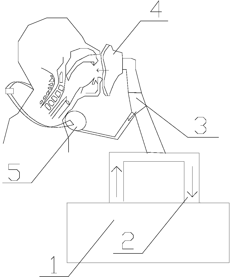 Ventilation sleeve element with percutaneous synchronous esophagus pressurizing function