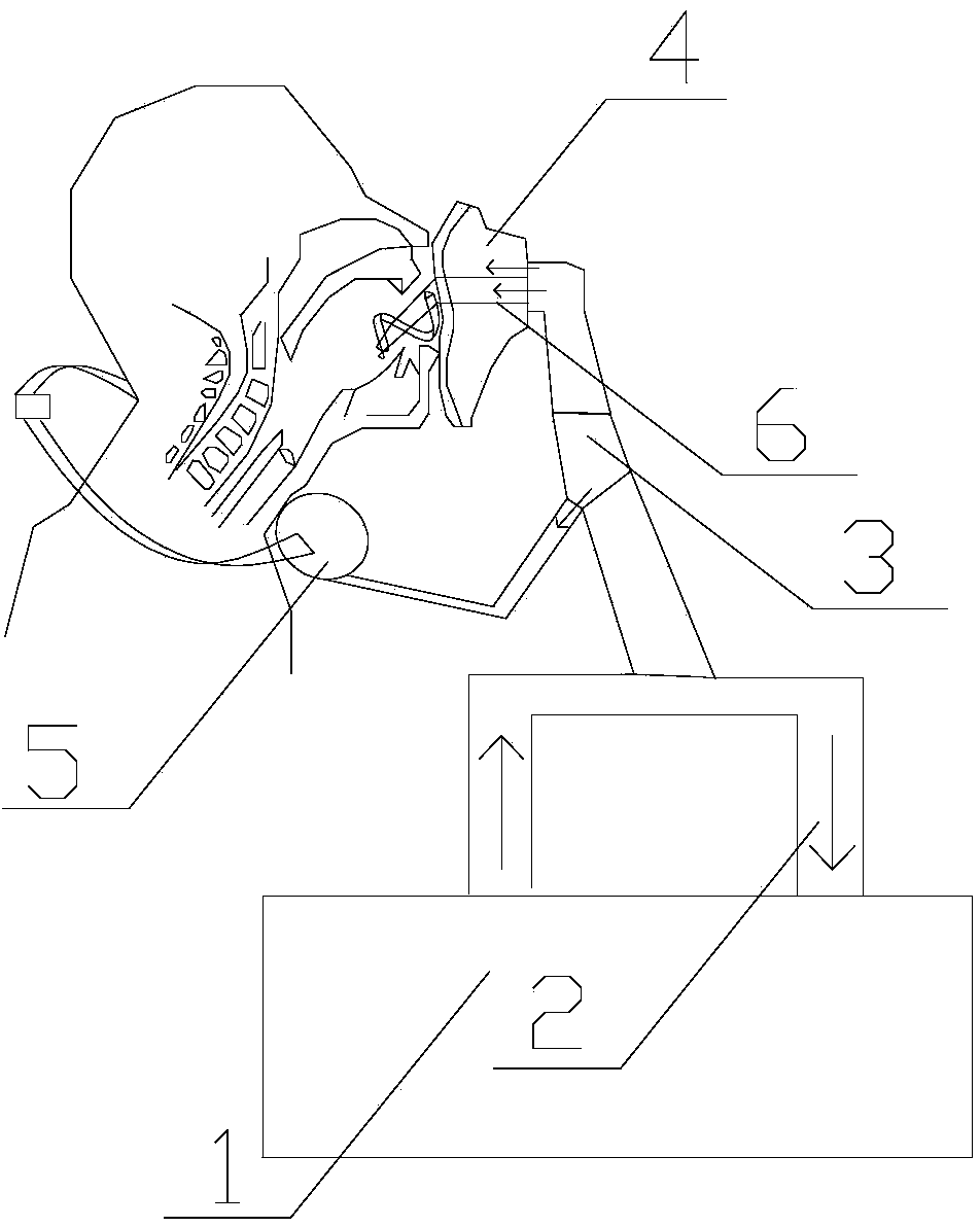 Ventilation sleeve element with percutaneous synchronous esophagus pressurizing function