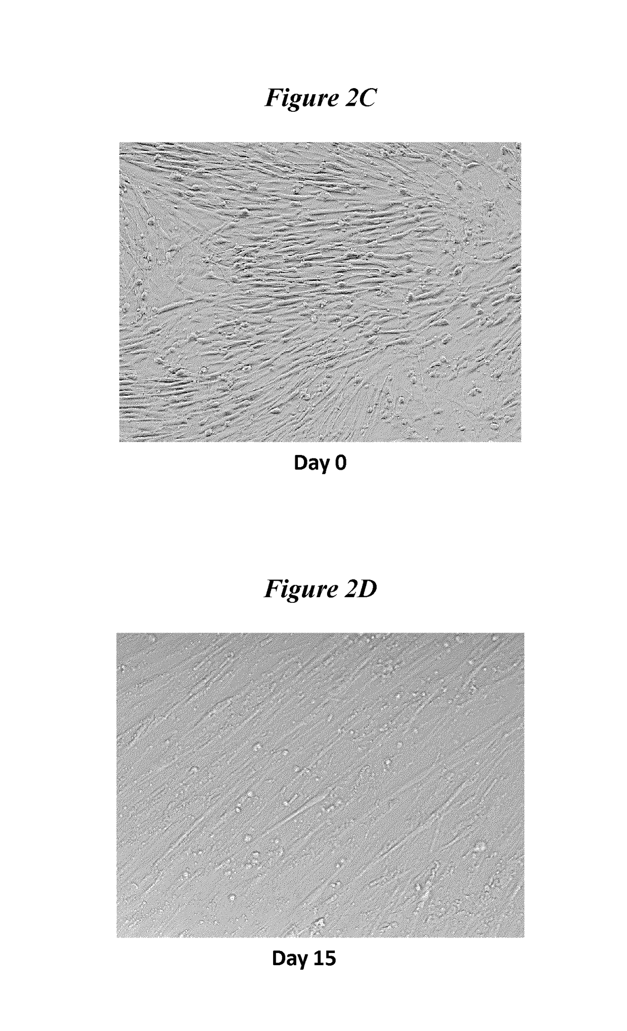 Exosomes and micro-ribonucleic acids for tissue regeneration