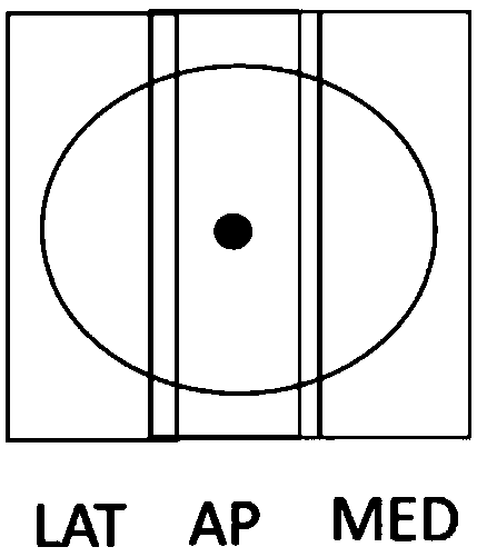 Three-dimensional breast ultrasound scanning method and ultrasound scanning system