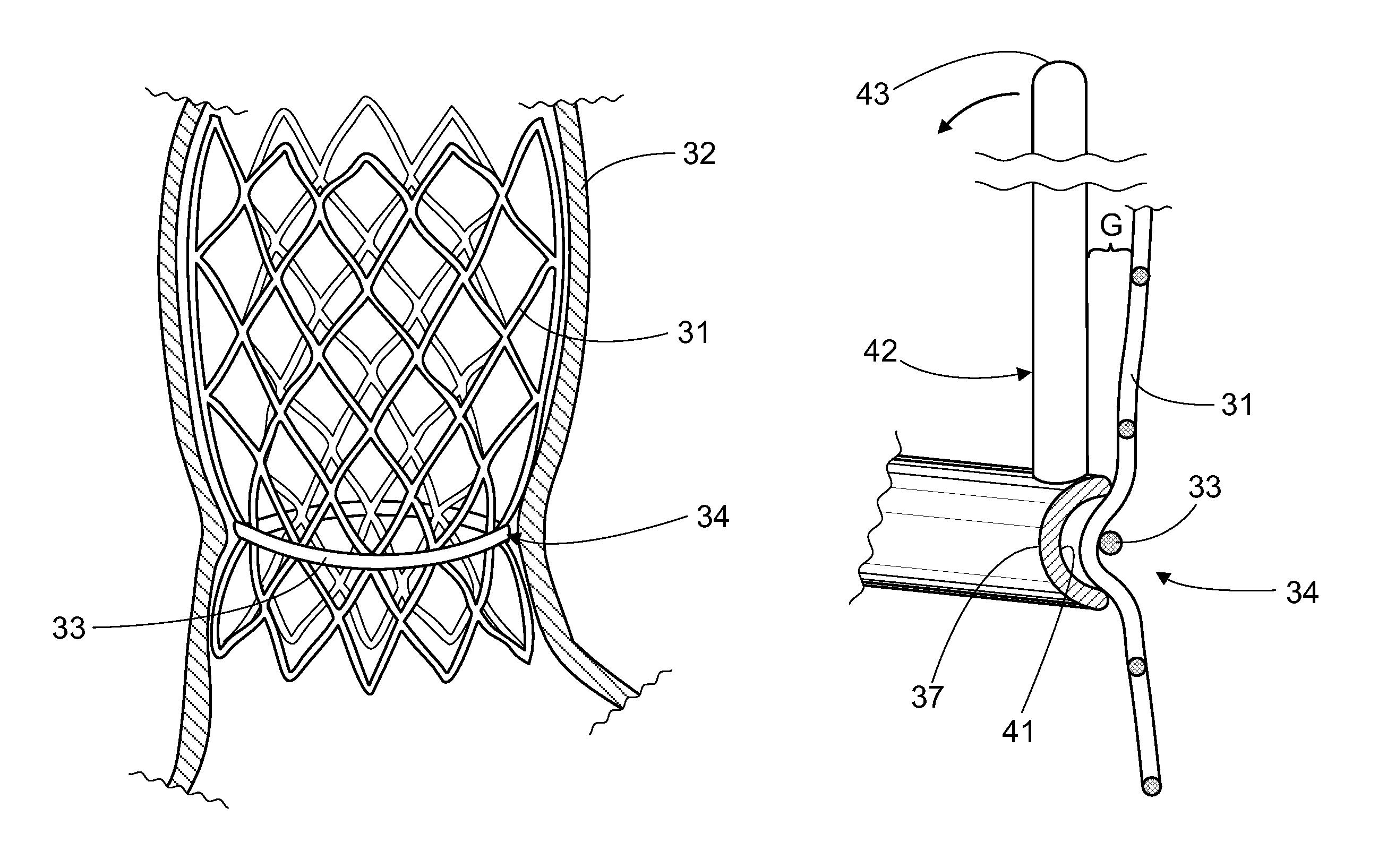 Prosthetic valve for intraluminal implantation