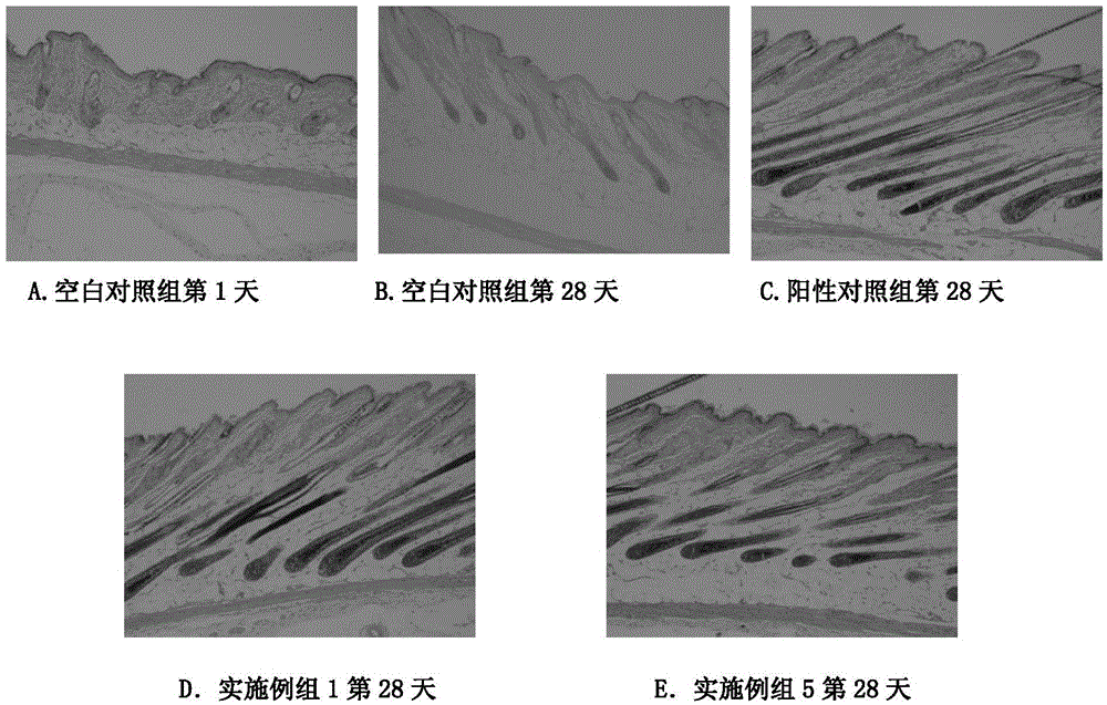 A kind of external Chinese medicine composition with hair growth and anti-hair loss effect and preparation method thereof