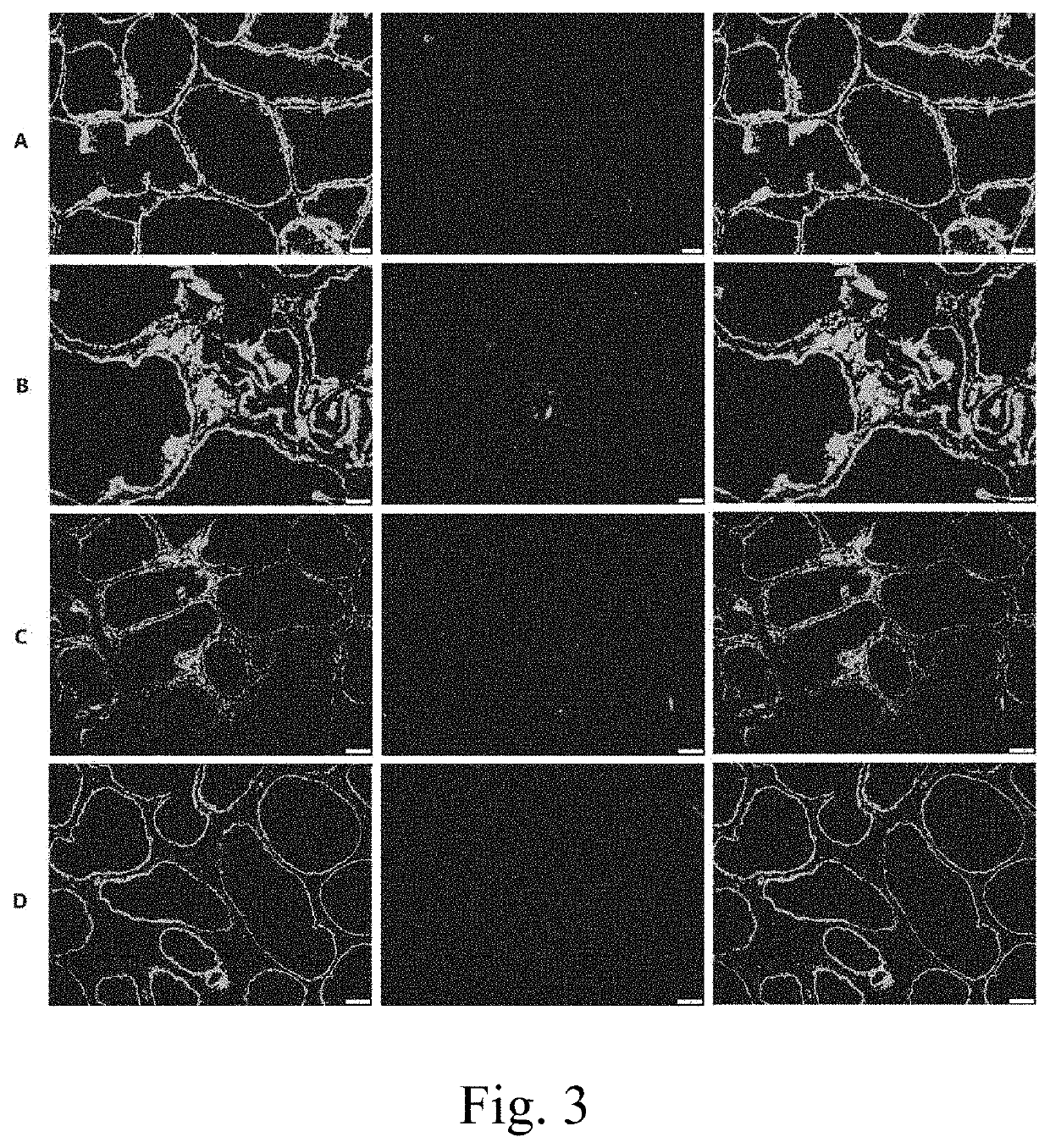 Application of TRPM8 protein, related peptide fragment and their antibodies