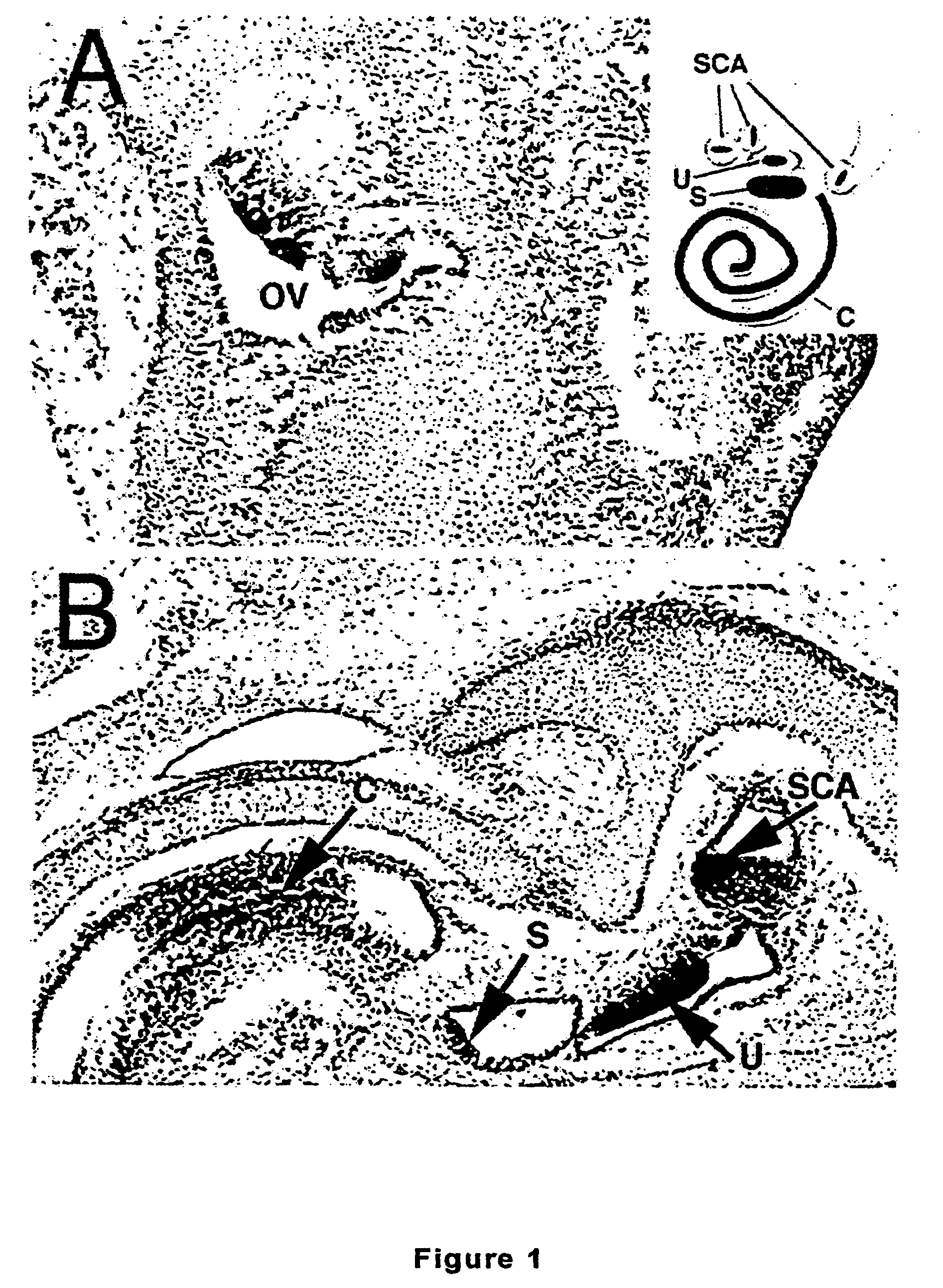 Compositions and methods for the therapeutic use of an atonal-associated sequence for deafness, osteoarthritis, and abnormal cell proliferation