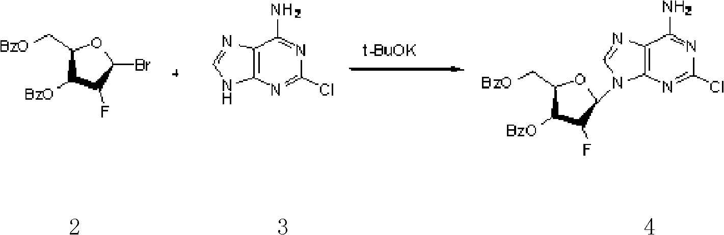 Clofarabine pharmaceutical composition freeze-dried powder injection and preparation method thereof