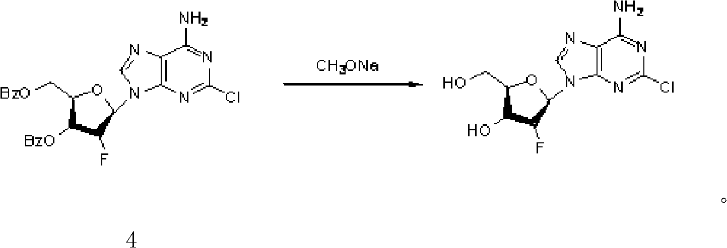 Clofarabine pharmaceutical composition freeze-dried powder injection and preparation method thereof