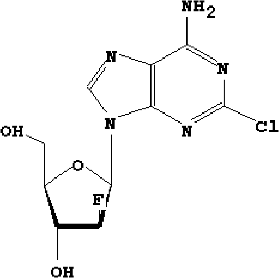 Clofarabine pharmaceutical composition freeze-dried powder injection and preparation method thereof