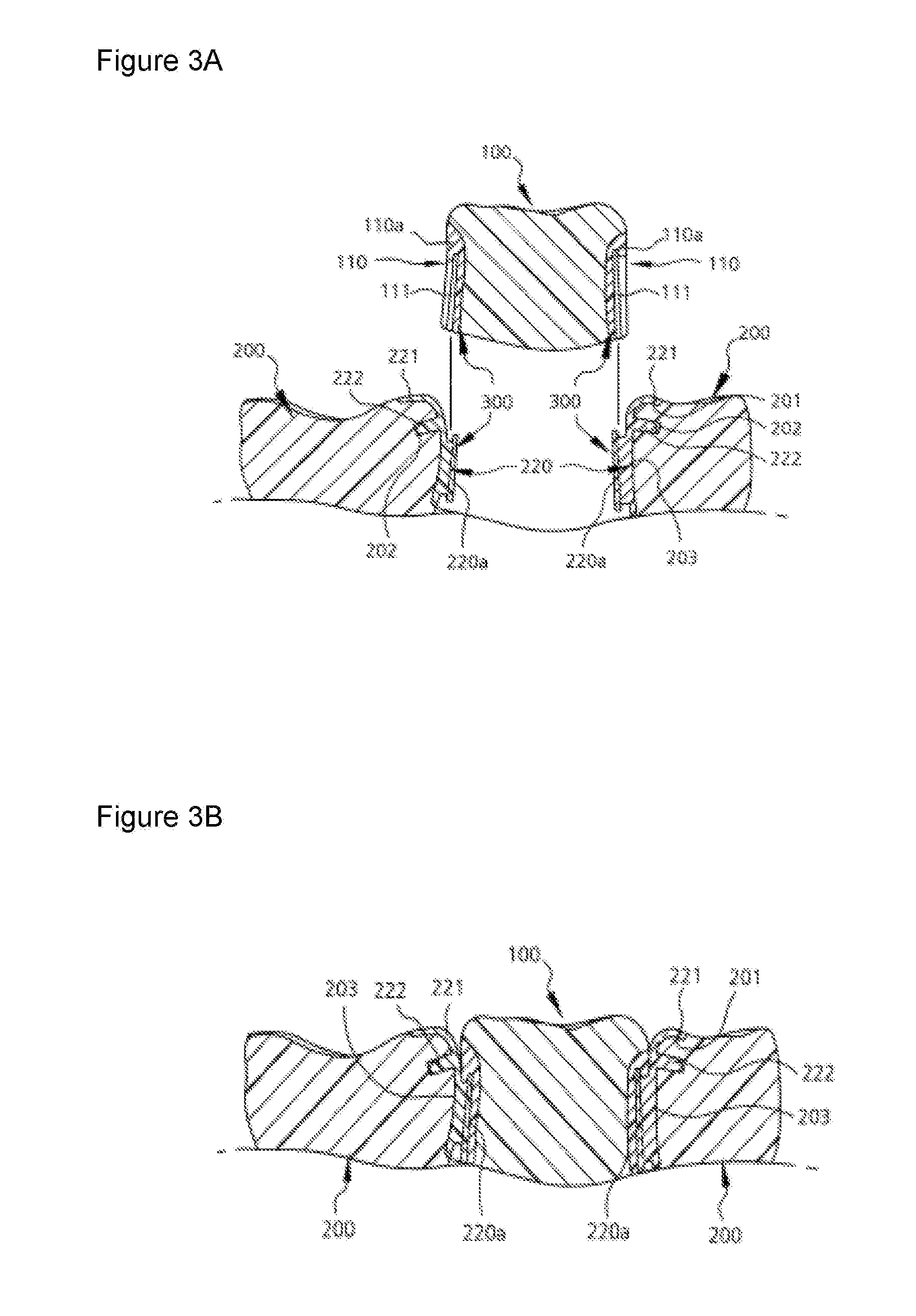 Dental prosthetic appliance