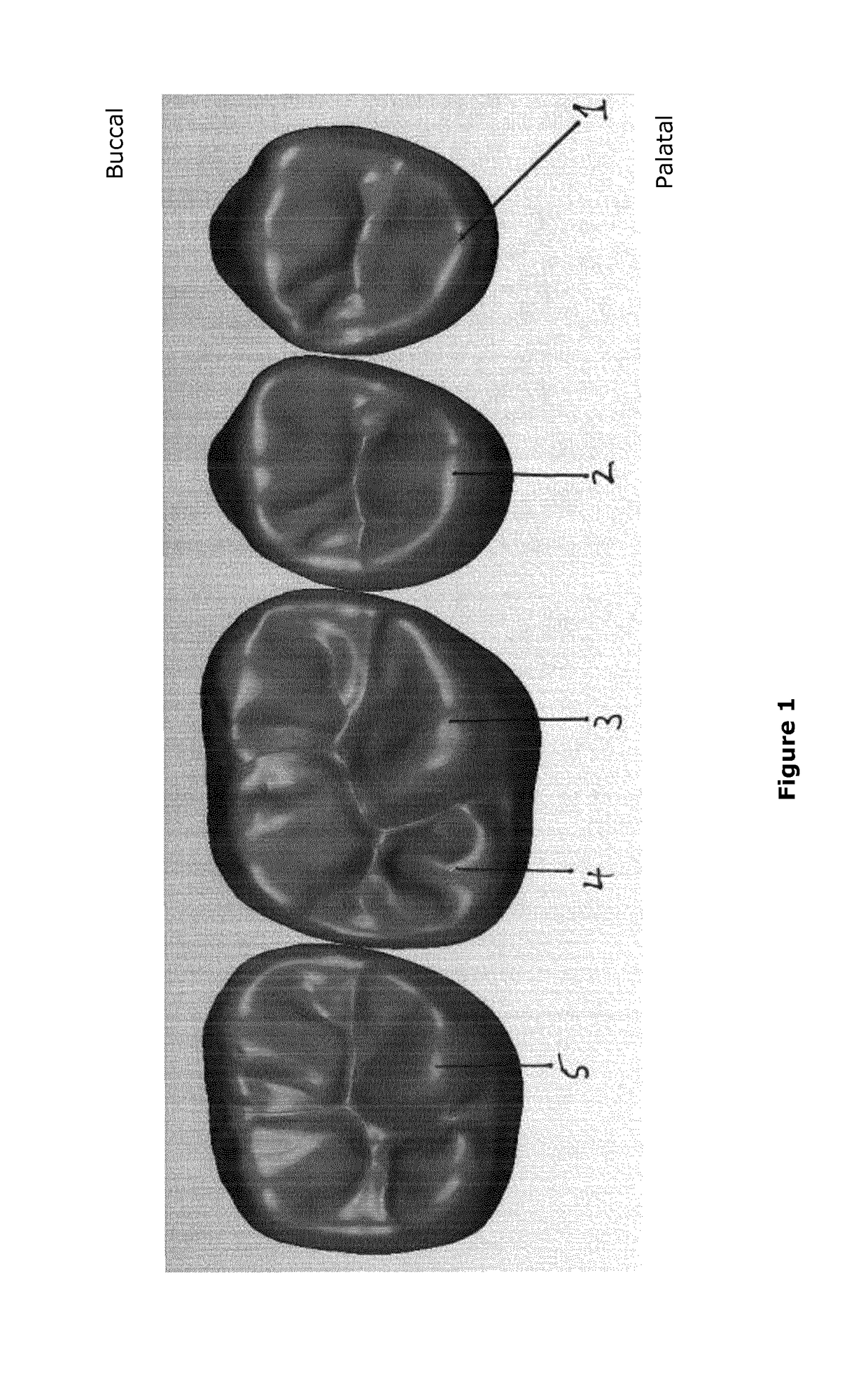 Artificial teeth