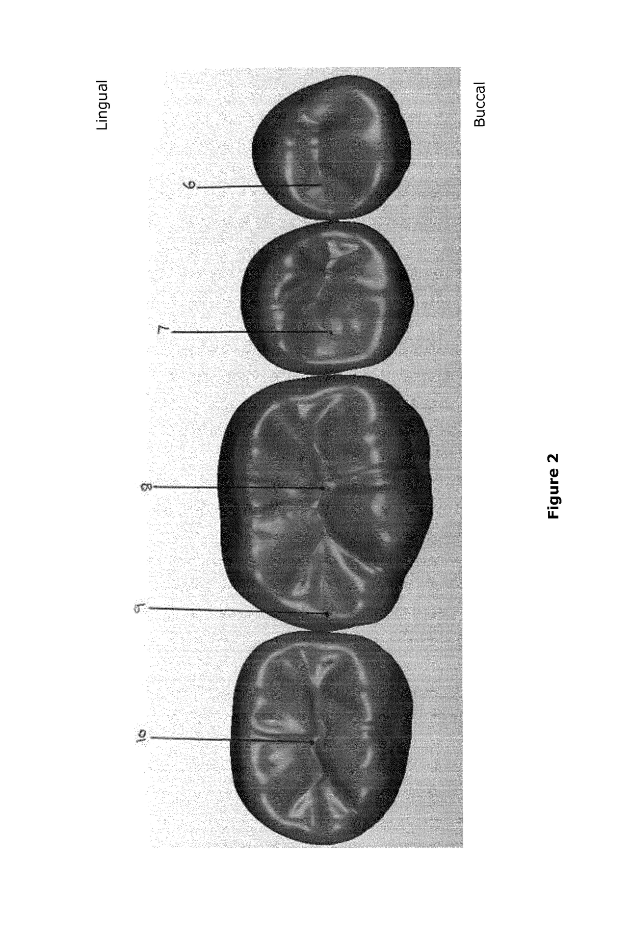 Artificial teeth