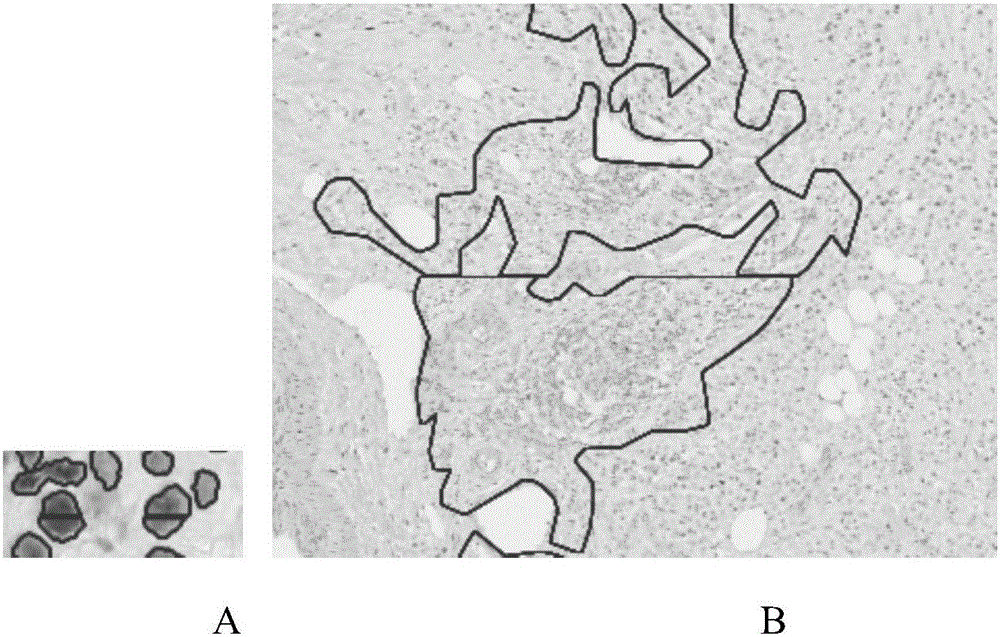 Whole slide digital pathological image processing and analysis method