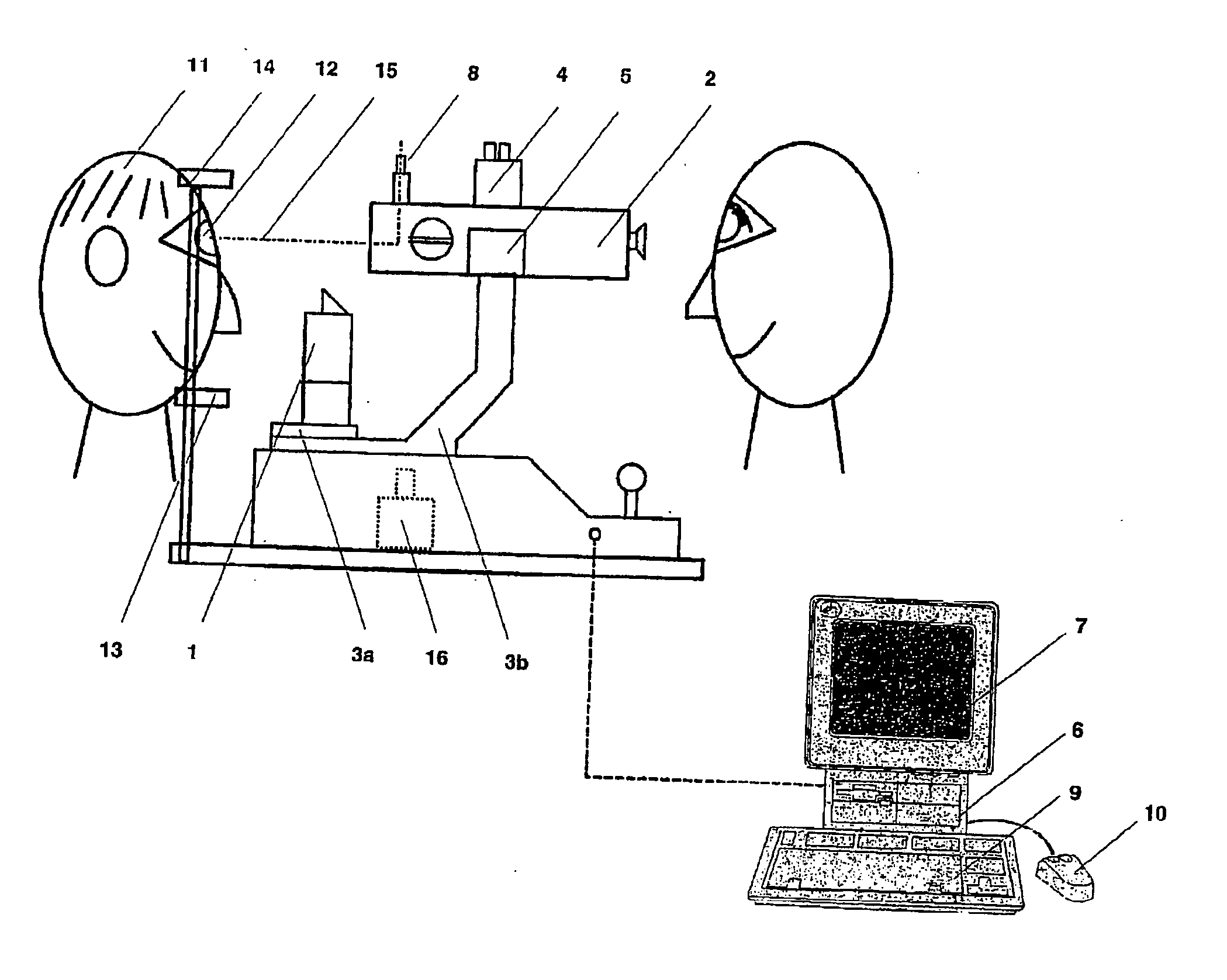 Ophthalmologic apparatus and related positioning method