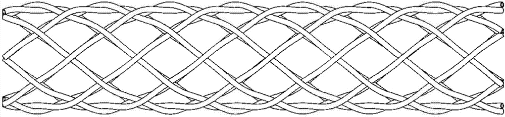 Expandable variable rigidity snake-shaped carrier for natural orifice surgery and application method thereof