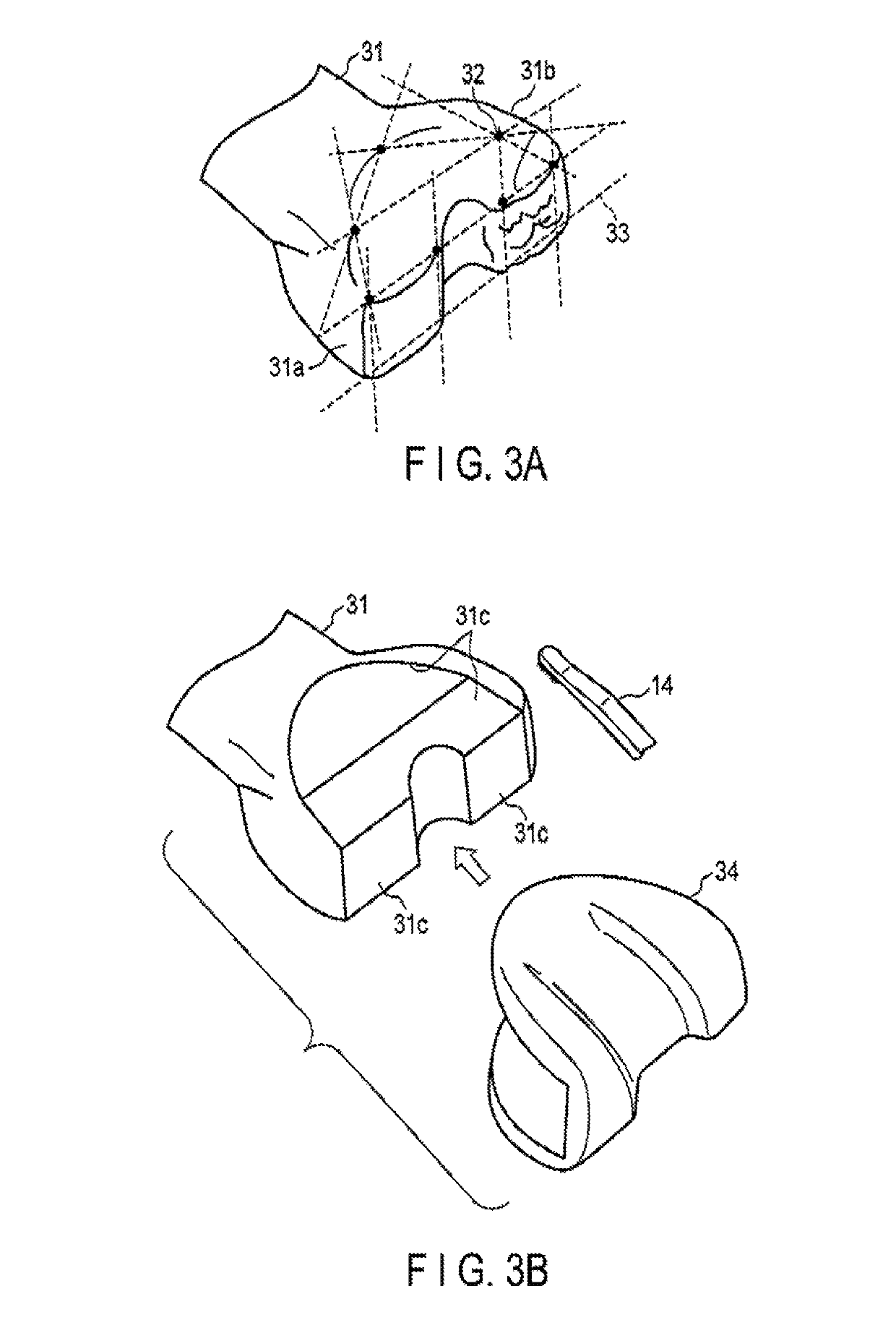 Method for replacement arthroplasty