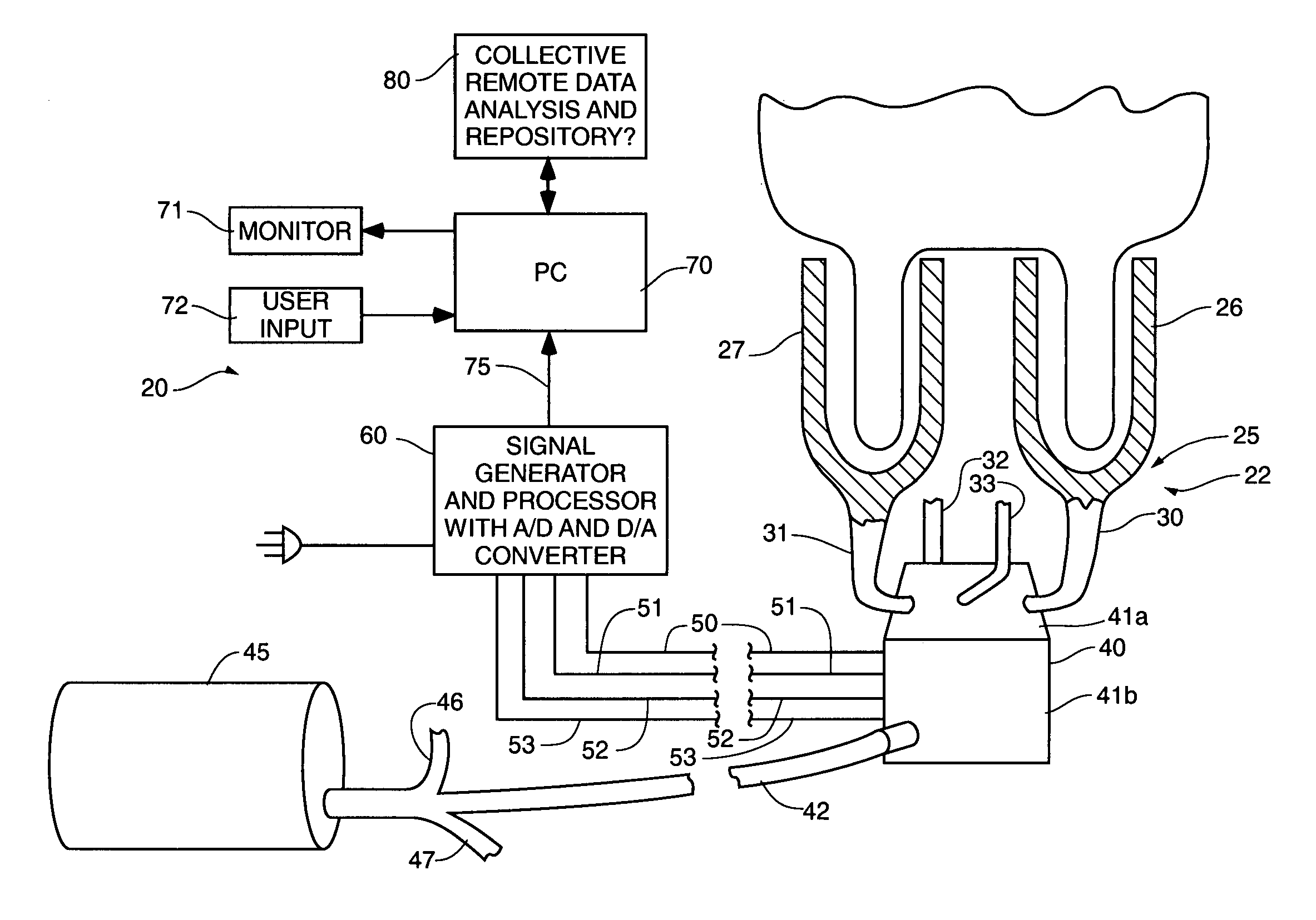 System and method of detecting disease in mammal