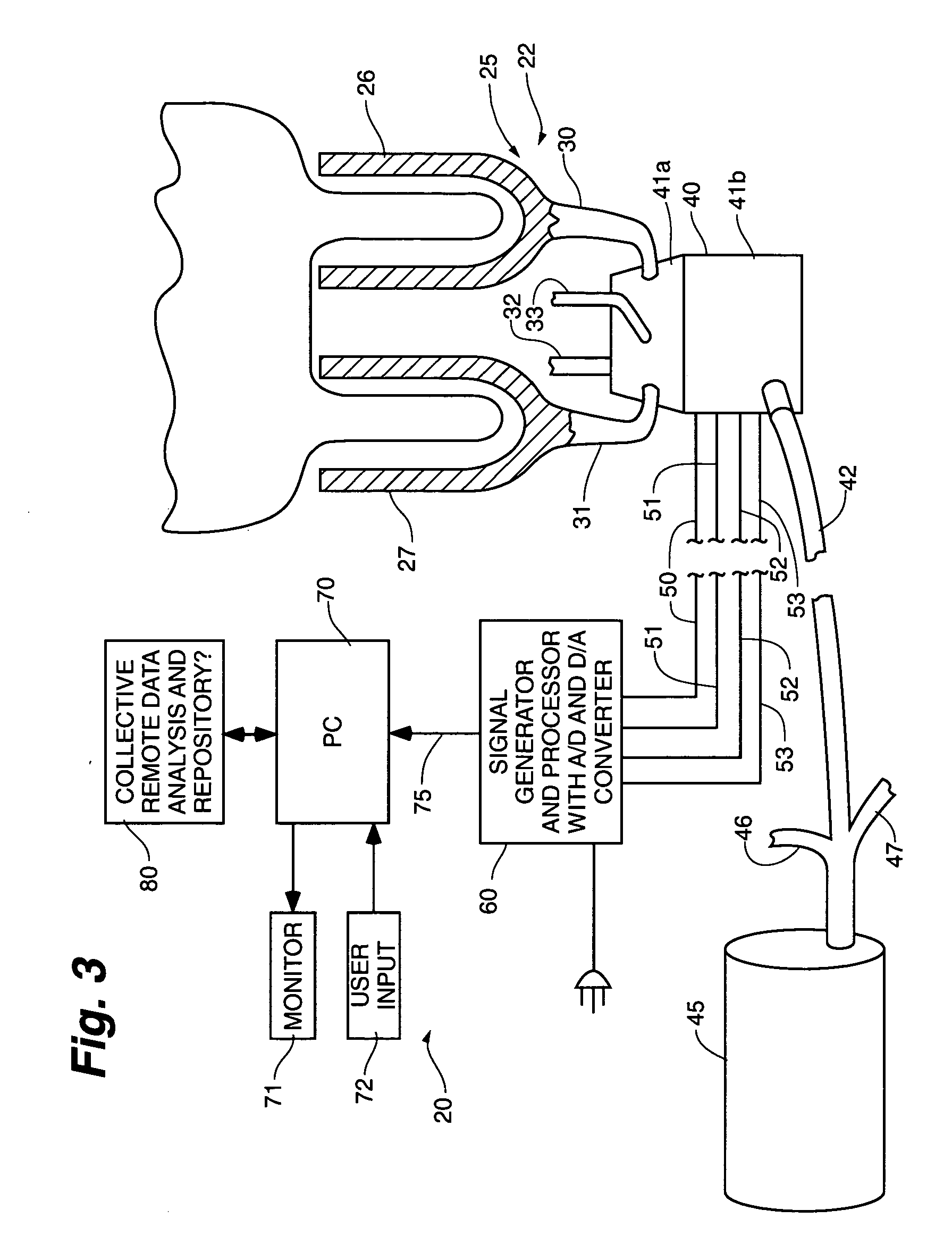 System and method of detecting disease in mammal