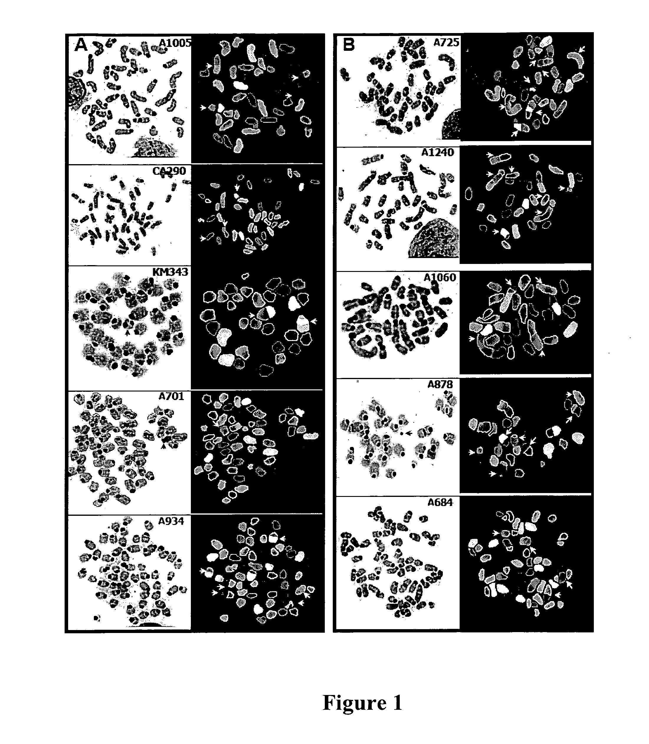 Compositions and methods for cancer gene discovery