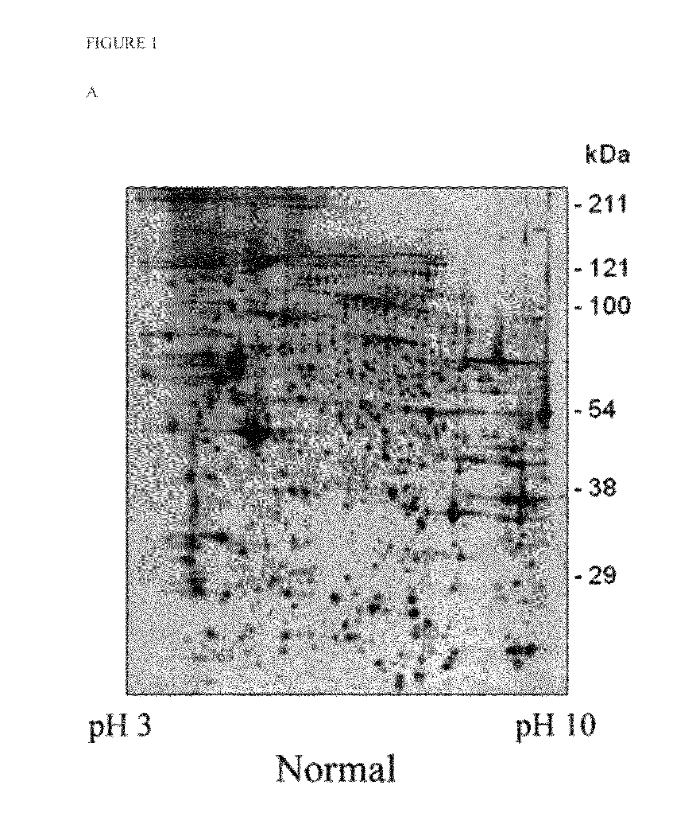 Method of regulating the expression level of survival of motor neuron 1