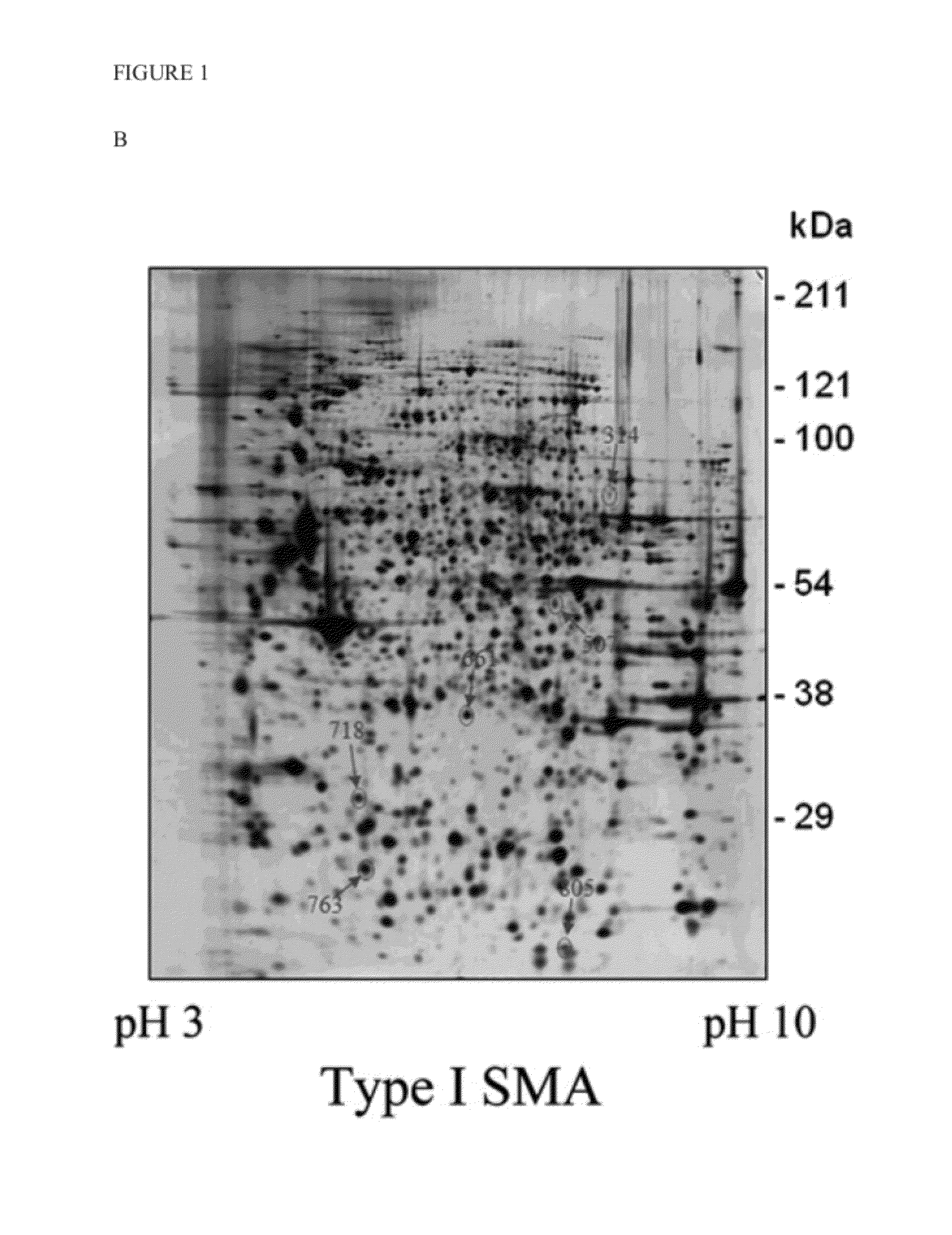 Method of regulating the expression level of survival of motor neuron 1