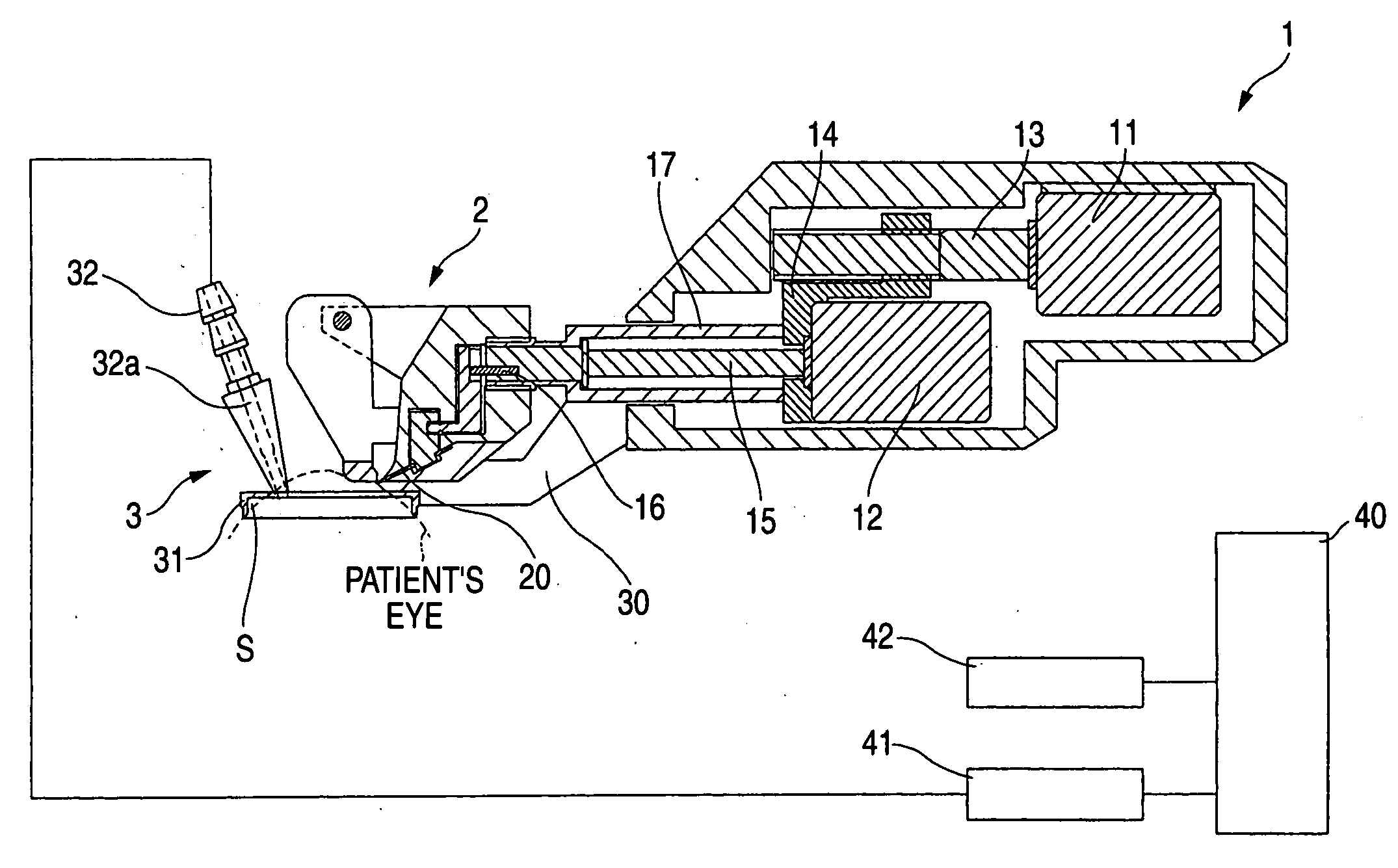 Corneal surgical apparatus