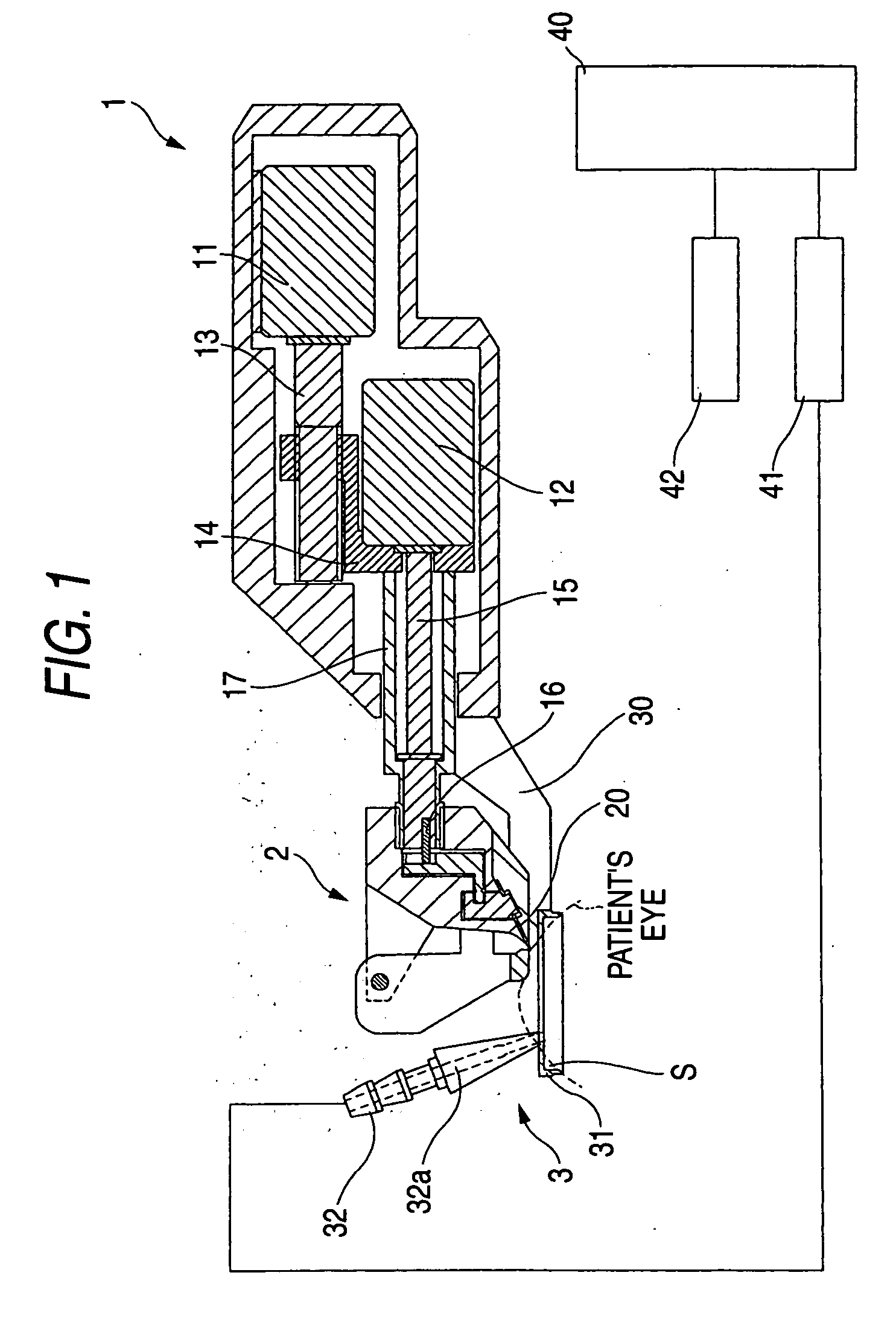 Corneal surgical apparatus