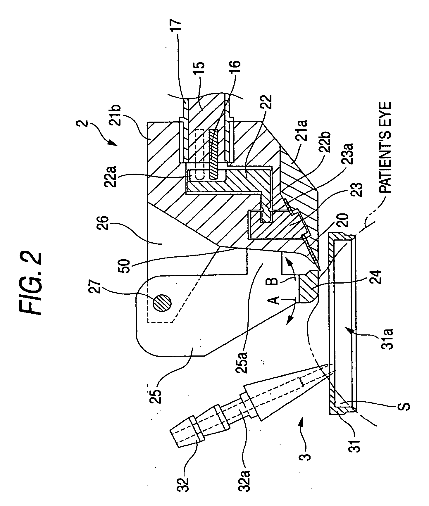 Corneal surgical apparatus