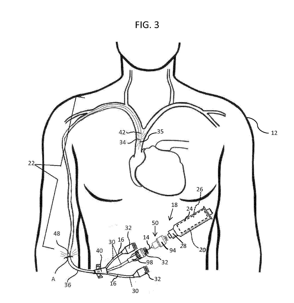 Methods and apparatus to deliver therapeutic, non-ultraviolet electromagnetic radiation to inactivate infectious agents and/or to enhance healthy cell growth via a catheter residing in a body cavity