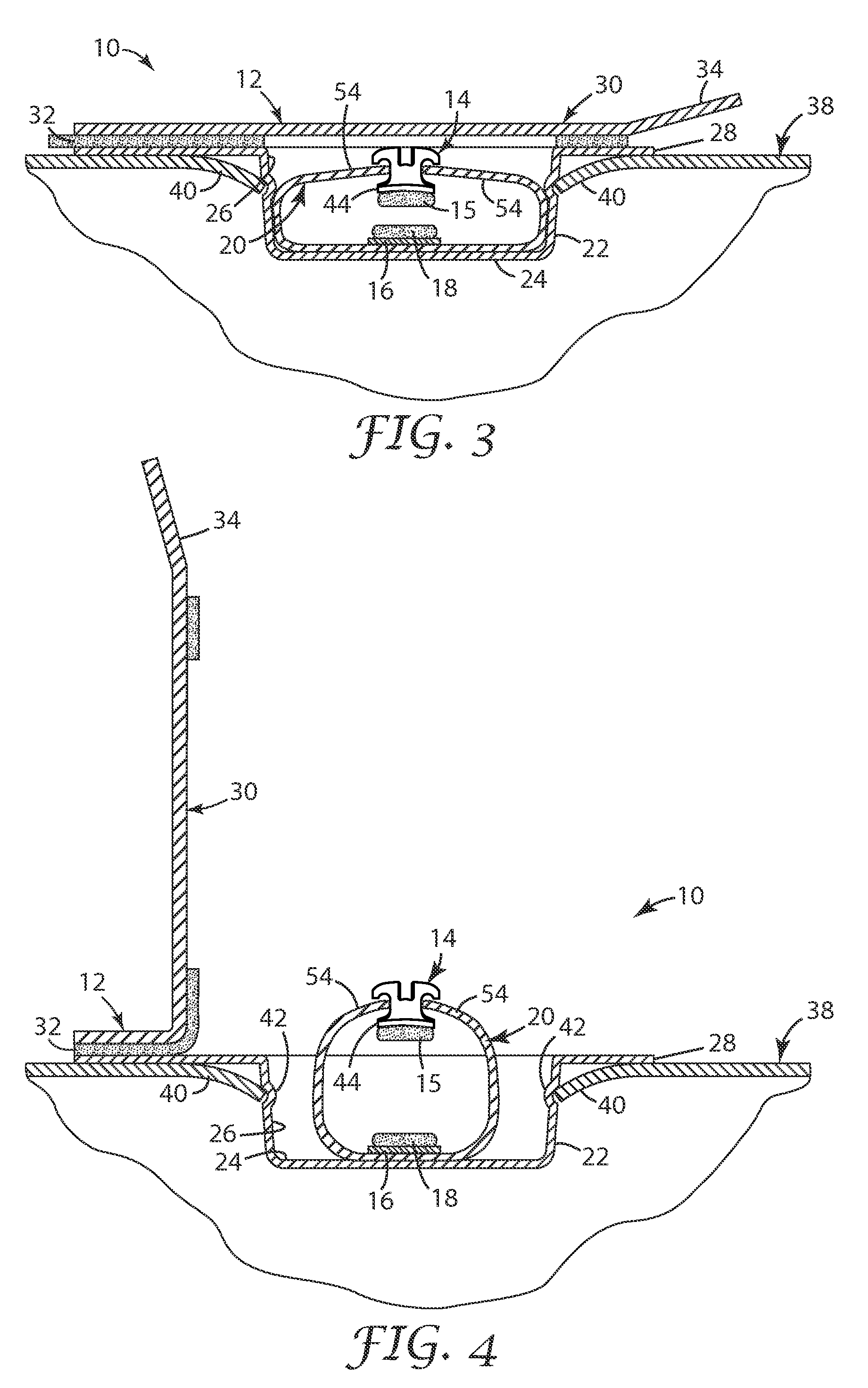 Packaged orthodontic appliance and adhesive material