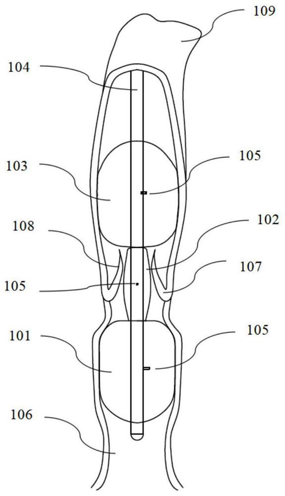 Vesicle-type serial expansion balloon for valves