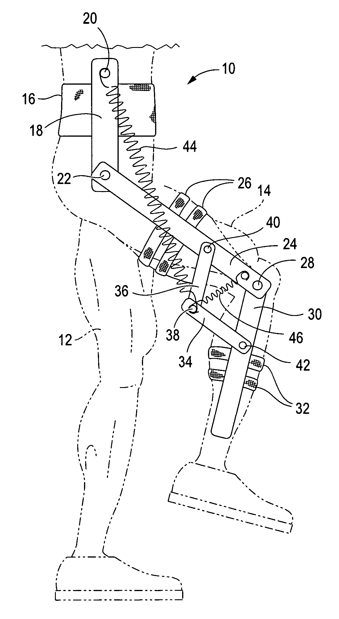 Gravity balanced orthosis apparatus