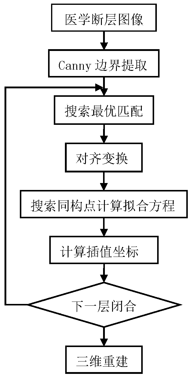 Artificial bone repair model reconstruction method based on prior knowledge