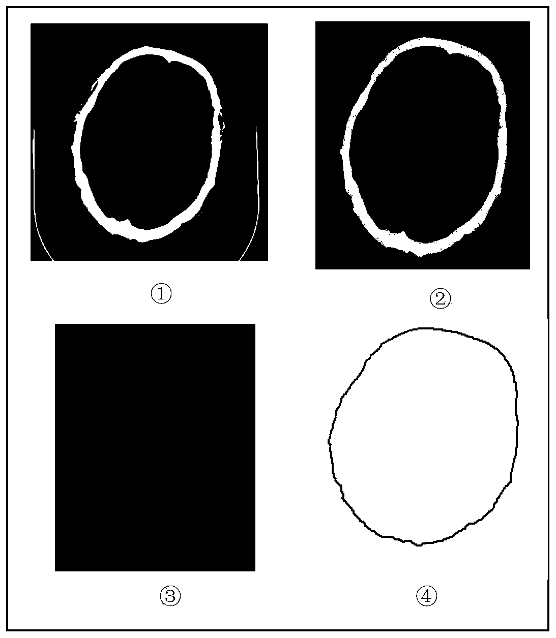 Artificial bone repair model reconstruction method based on prior knowledge