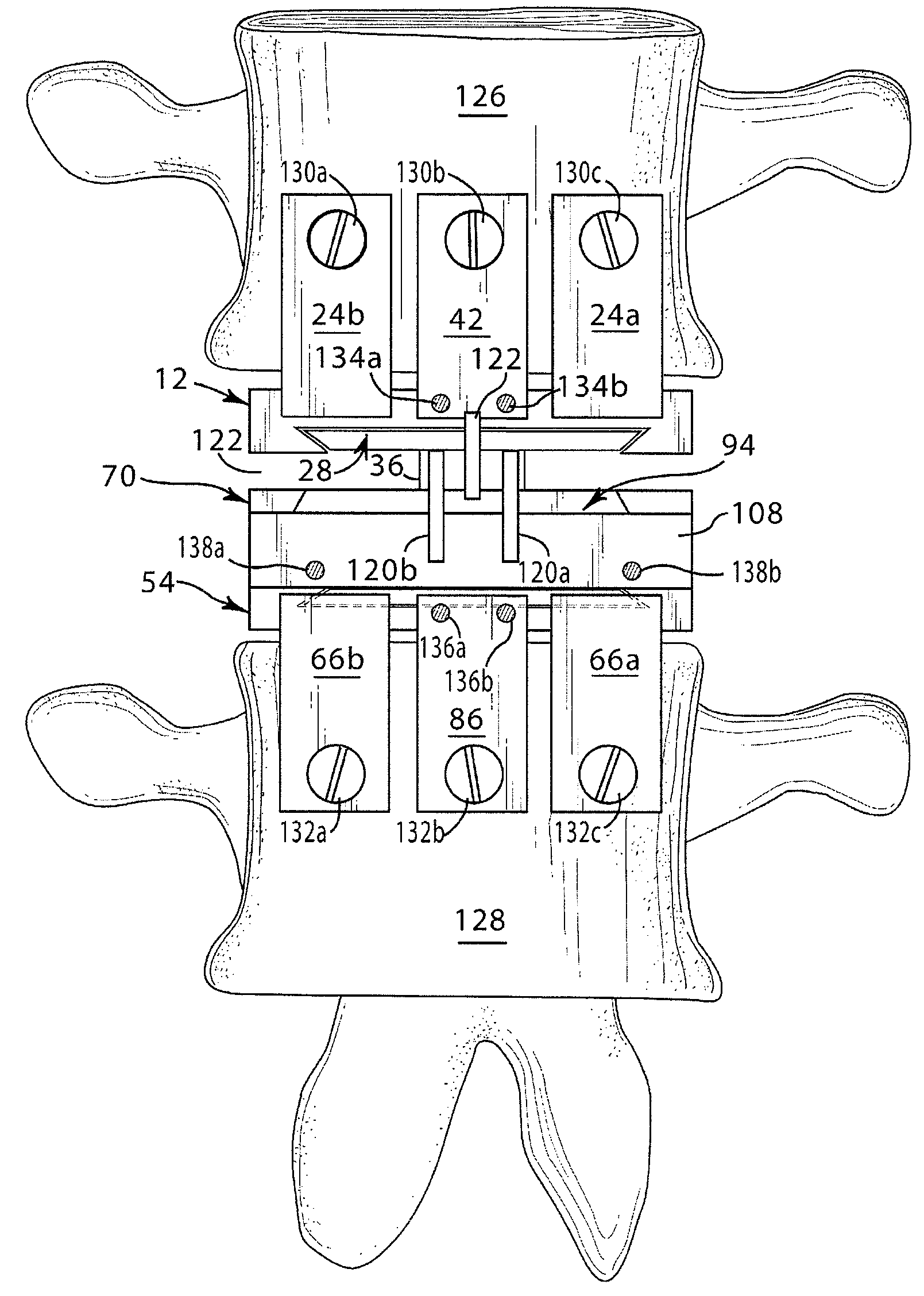 Artificial spinal disk