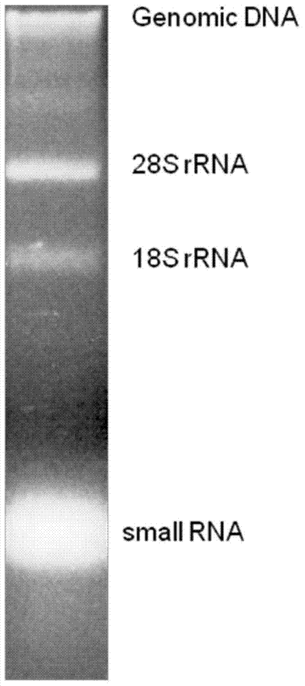 Method for extracting ribonucleic acid from blood