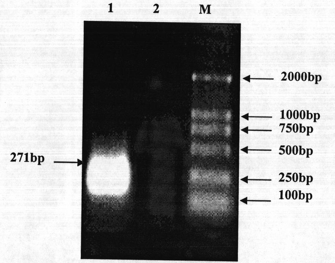 Mycoplasma hyopneumoniae P97R1 gene recombined Pichia pastoris and expression protein