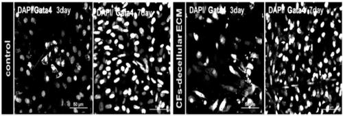 Method for improving efficiency of differentiating brown adipose-derived stem cells into cardiomyocytes