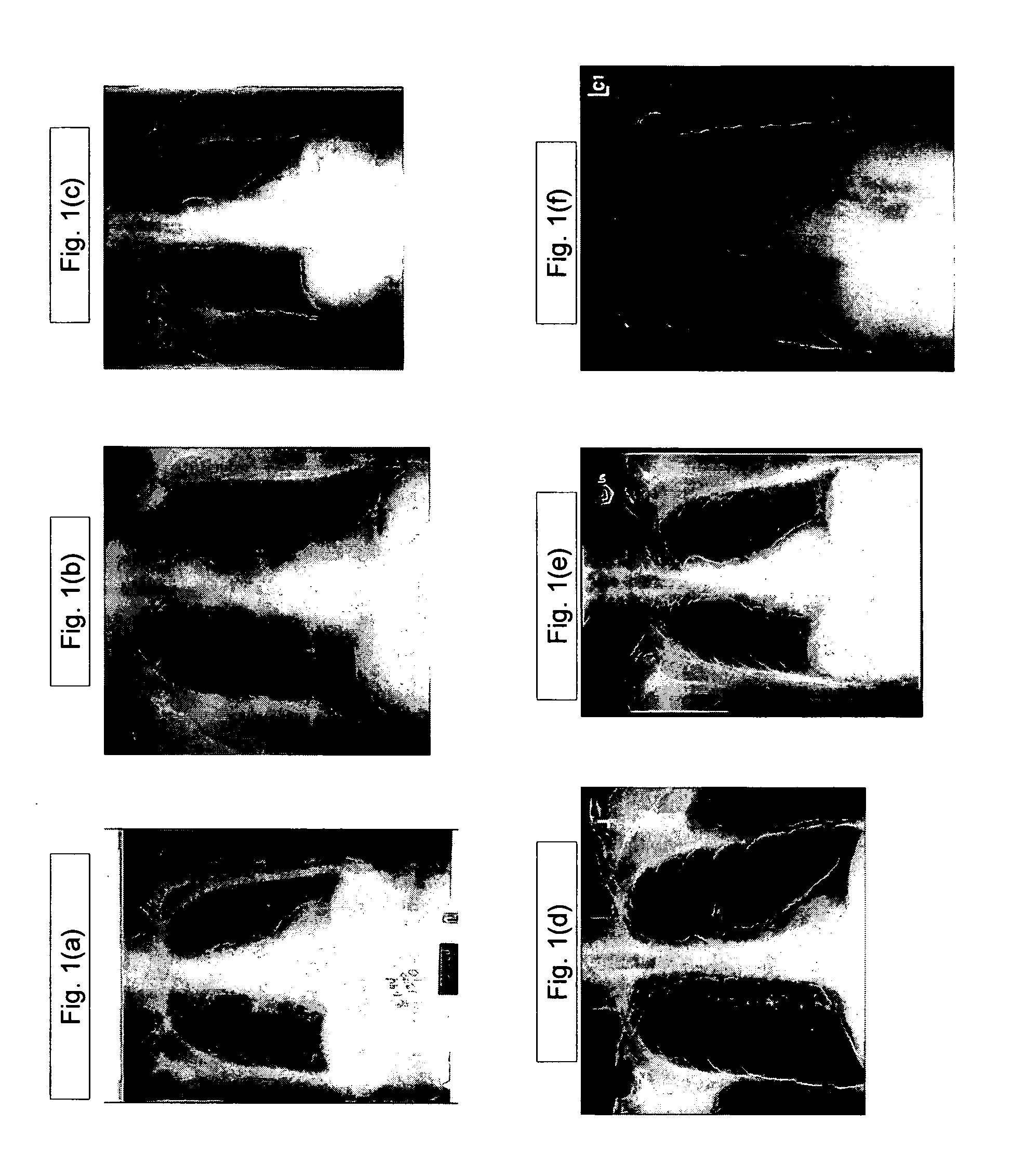 Lung contrast normalization on direct digital and digitized chest images for computer-aided detection (CAD) of early-stage lung cancer