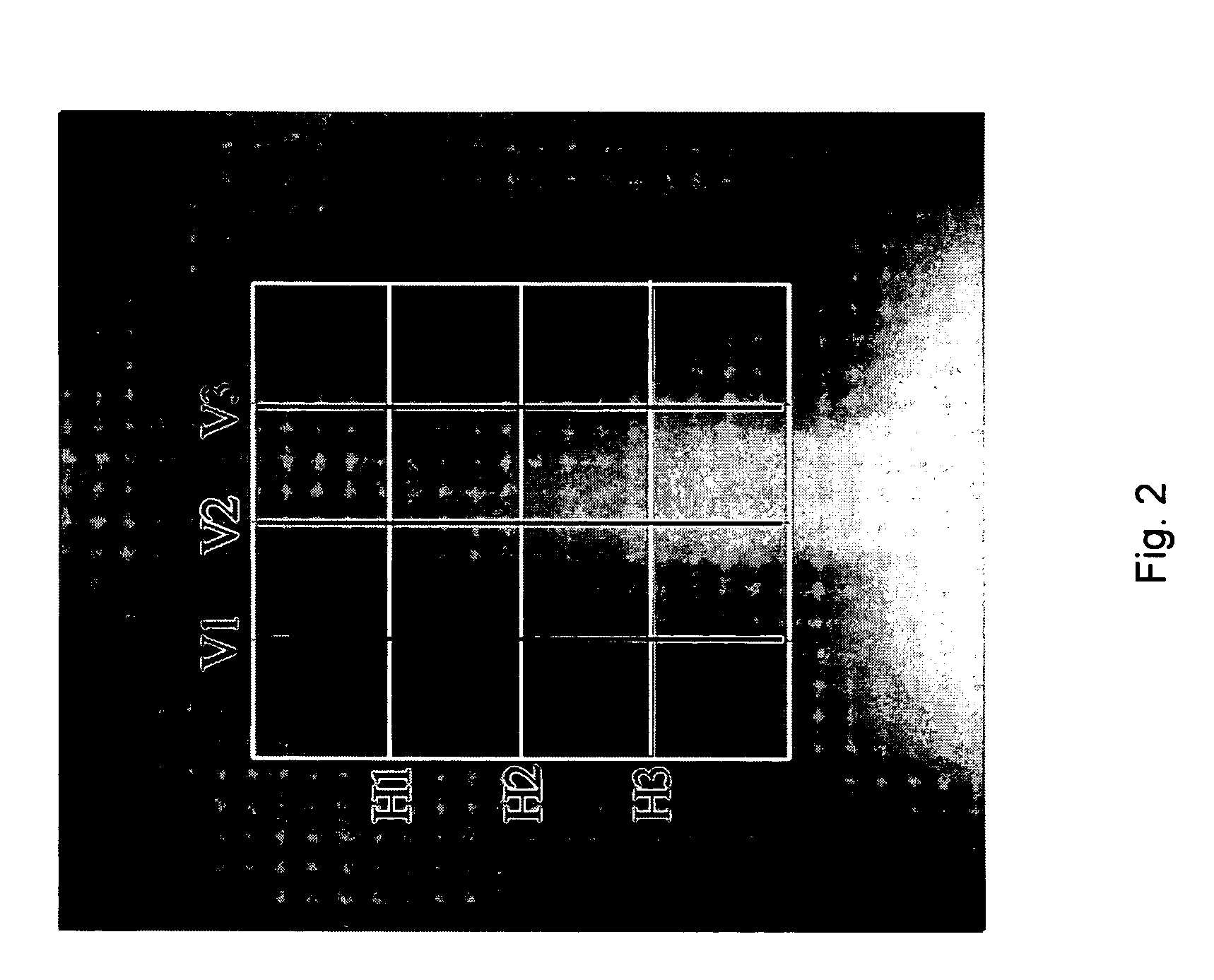 Lung contrast normalization on direct digital and digitized chest images for computer-aided detection (CAD) of early-stage lung cancer