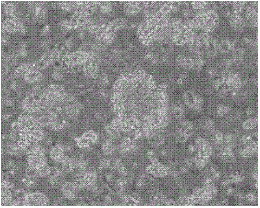 A method for isolating and culturing human meningioma cells