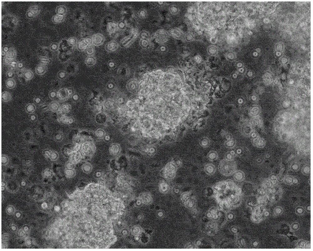 A method for isolating and culturing human meningioma cells