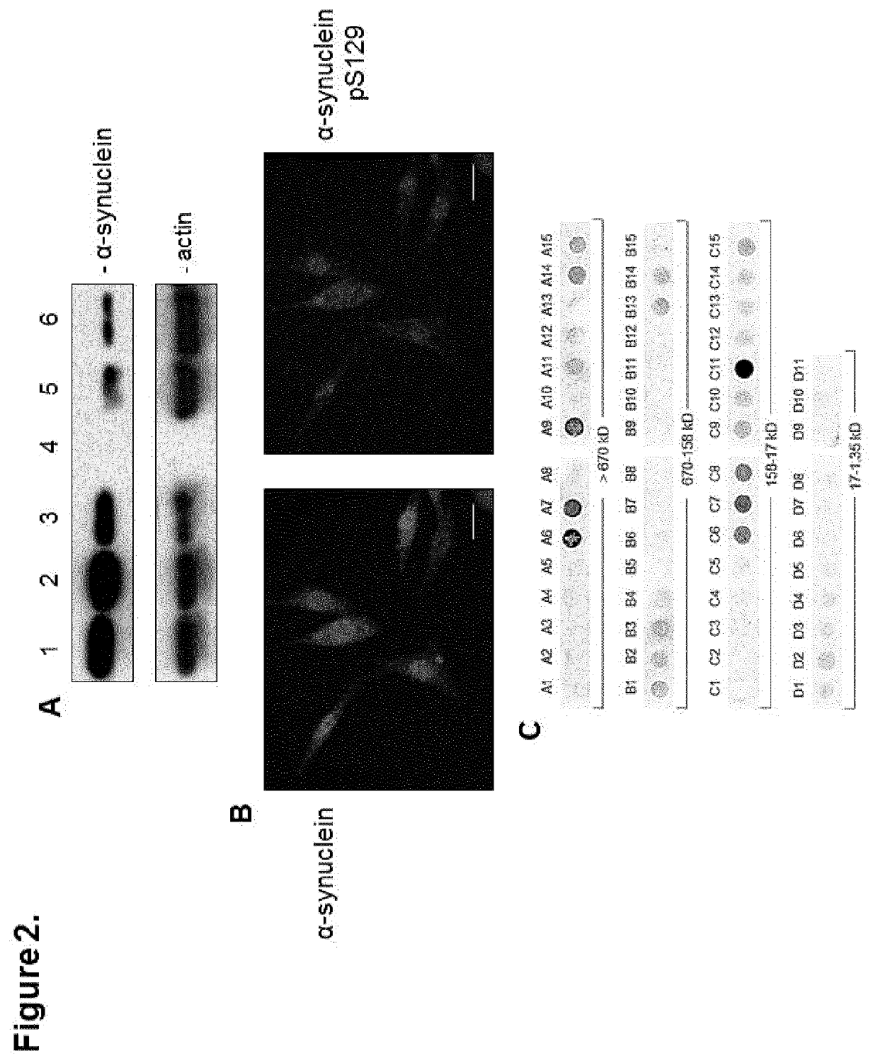 Phenyl-heterocycle-phenyl derivatives for use in the treatment or prevention of melanoma