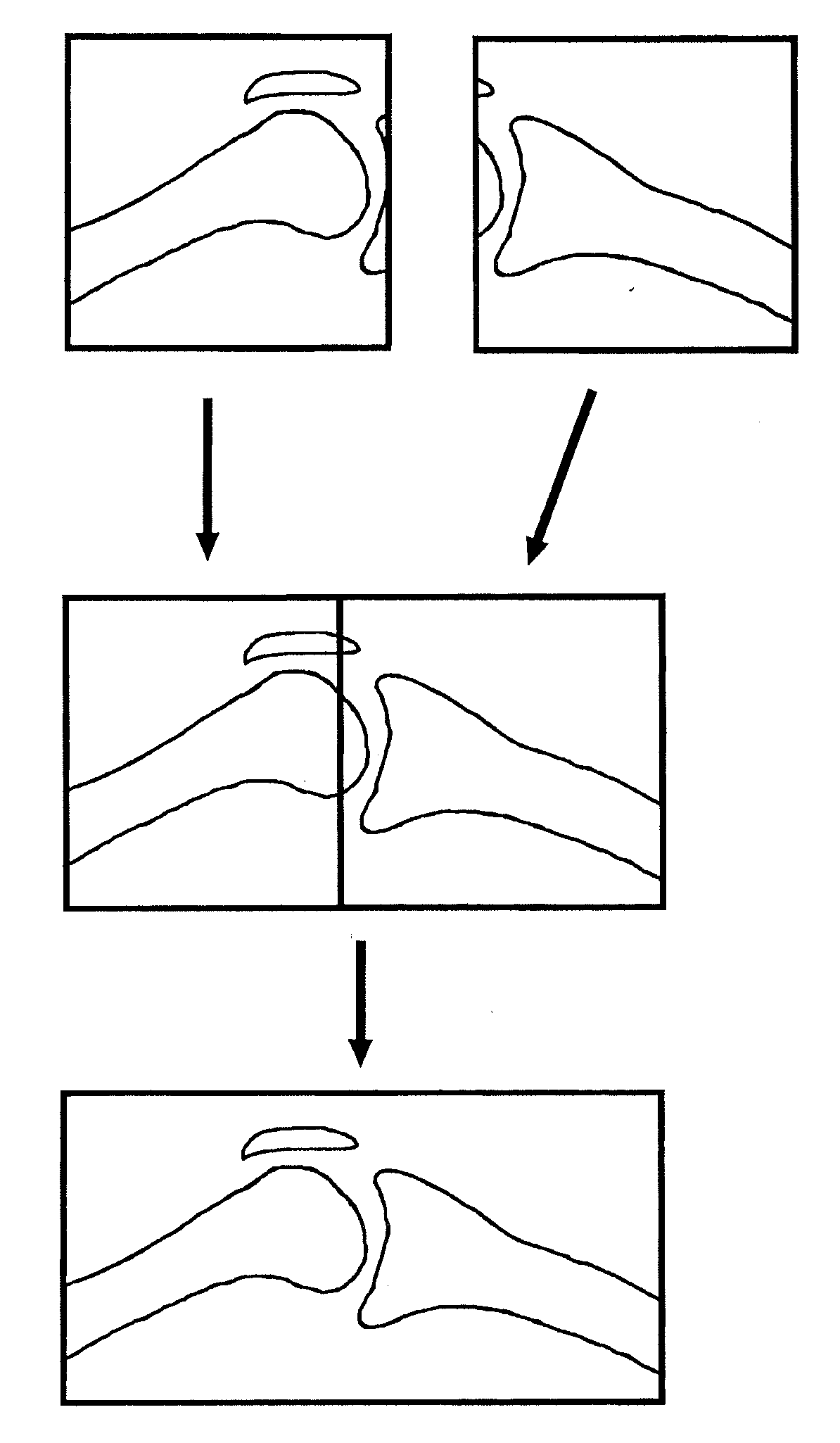 Image stitching and related method therefor